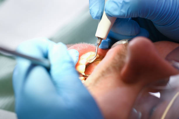 Best Tooth Infection Emergency Dentist  in Borrego Springs, CA