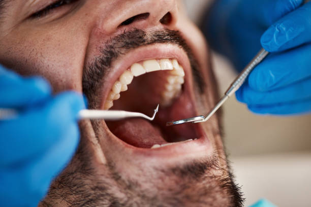 Best Dentist for Tooth Abscess  in Borrego Springs, CA